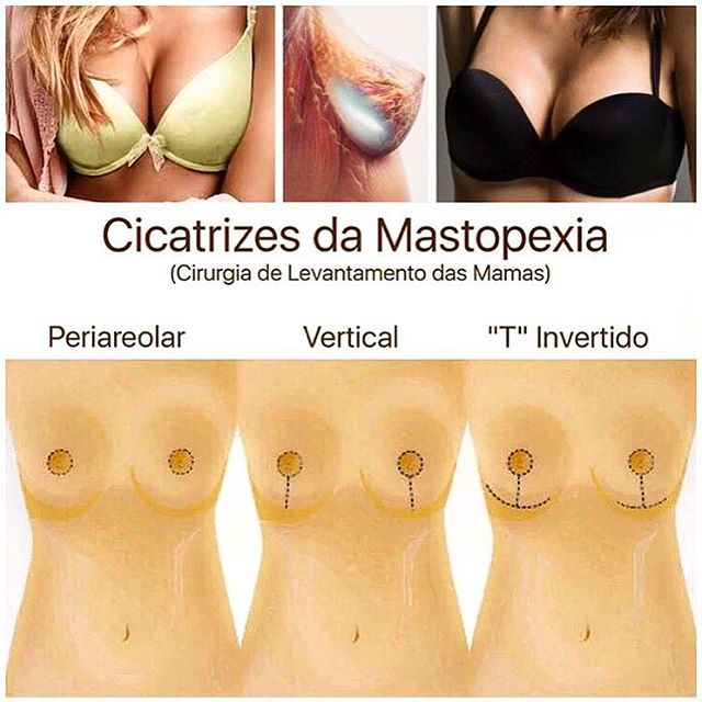 Comprar um nikoretta em Cazã