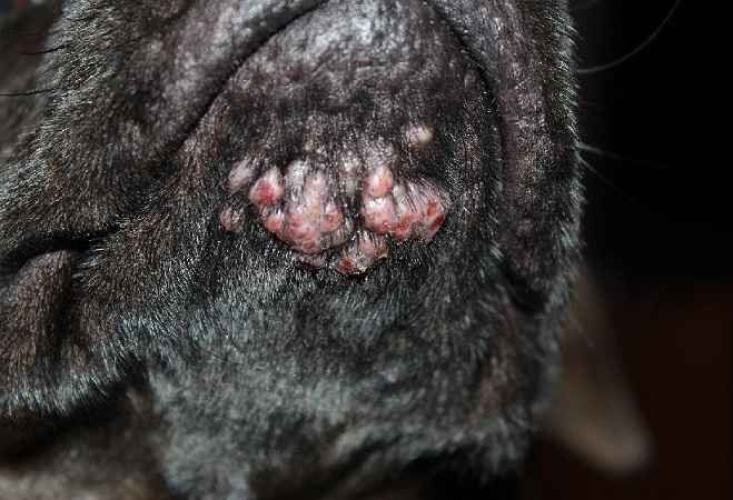 Tratamento de acne de um malyshev