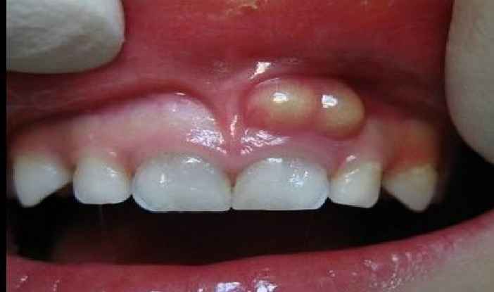 Consultar Um Dentista – Como Saber a Hora Certa